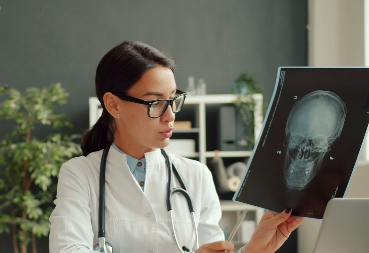 Médica de óculos segurando e examinando uma radiografia do crânio no consultório